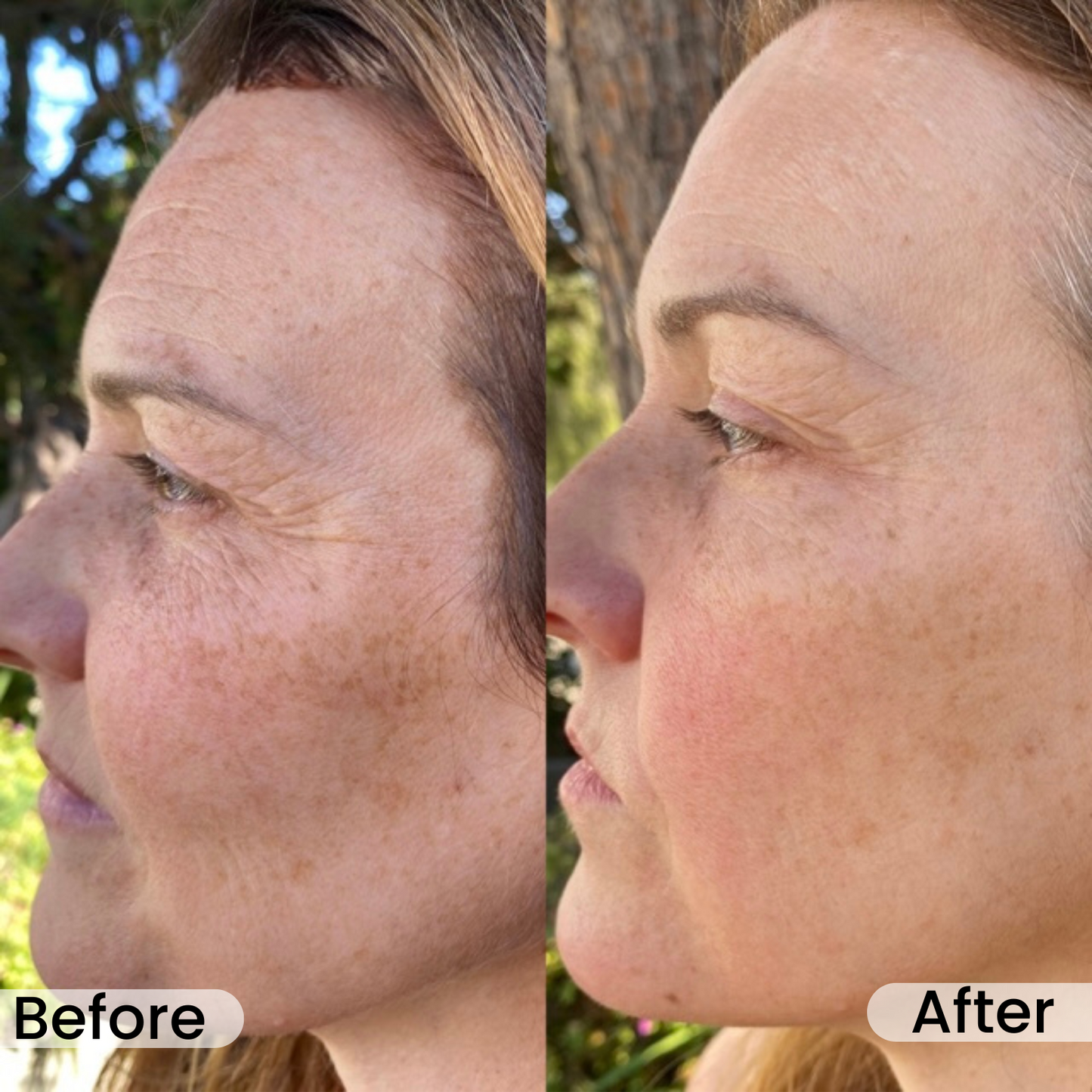 No More Wrinkles—Find Your Younger Self With NAD+