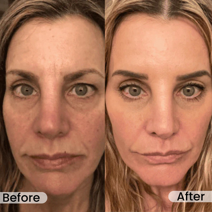 No More Wrinkles—Find Your Younger Self With NAD+
